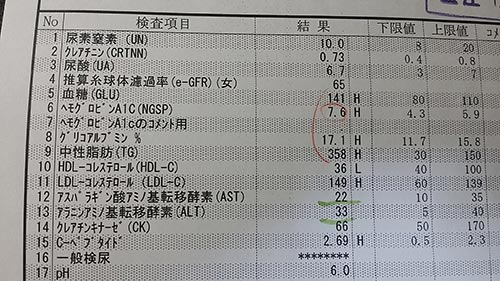 20141017_tonyo