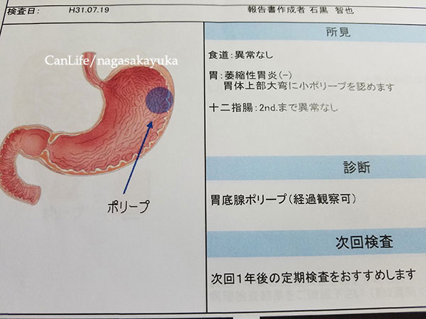 胃にポリープがあった