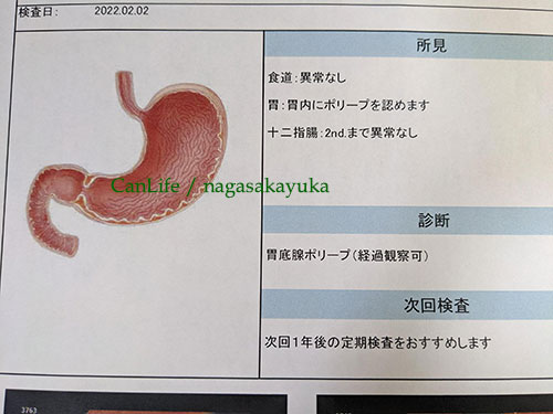 胃カメラの検査結果