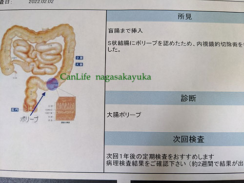 大腸内視鏡検査の結果